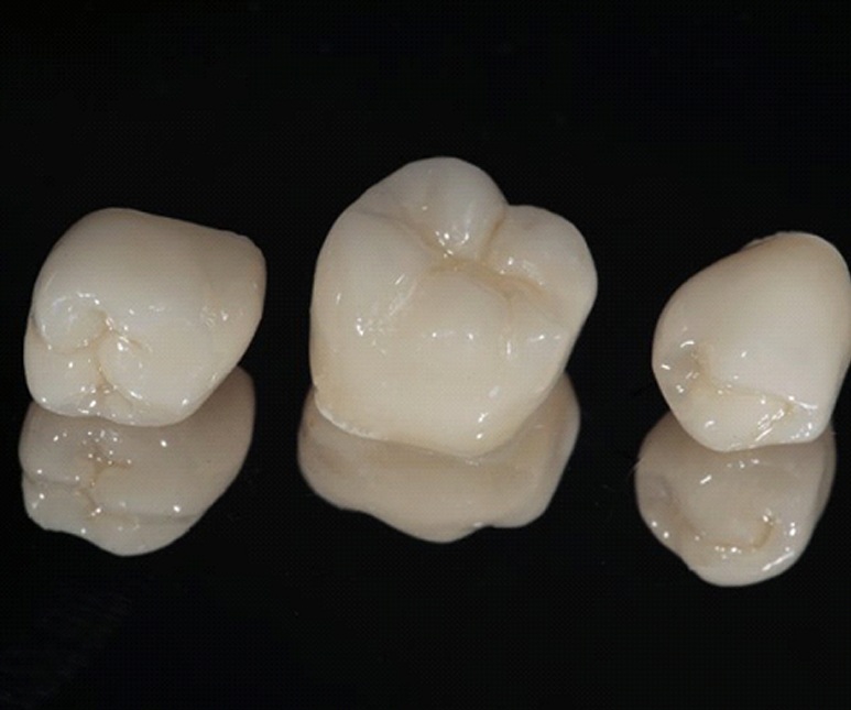 three dental crowns in Frisco against black background