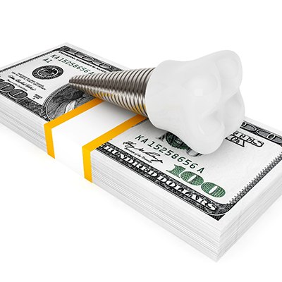 Model implant and money stack symbolizing the cost of dental implants in Frisco