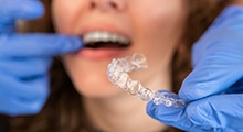 Closeup of dentist holding clear aligner with blue gloves