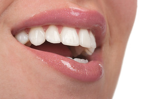 Close-up of woman smiling and showing her teeth